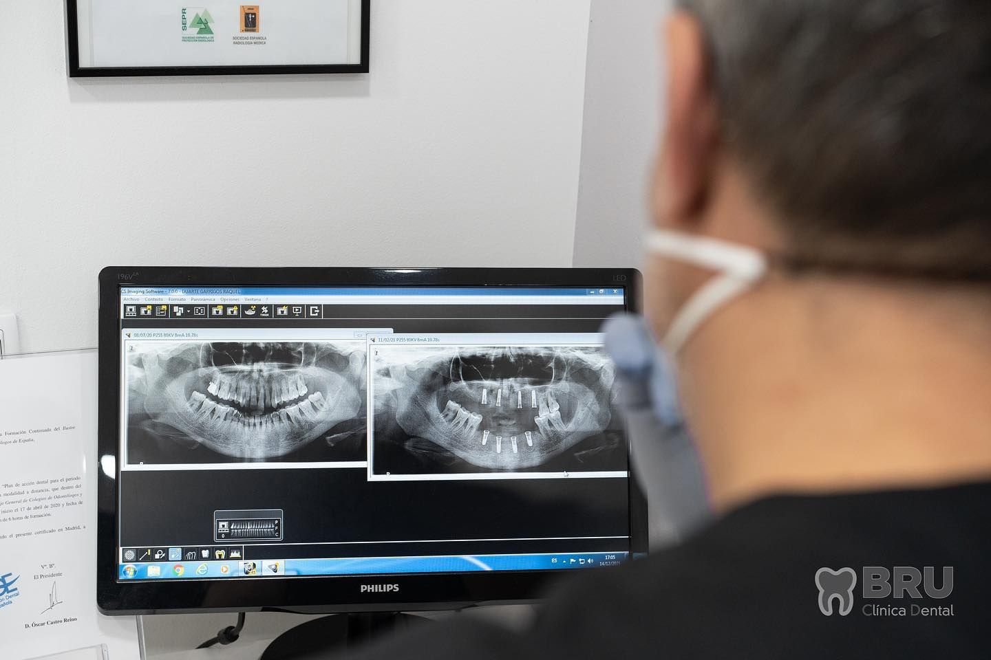 Estudi de radiografies a Bru